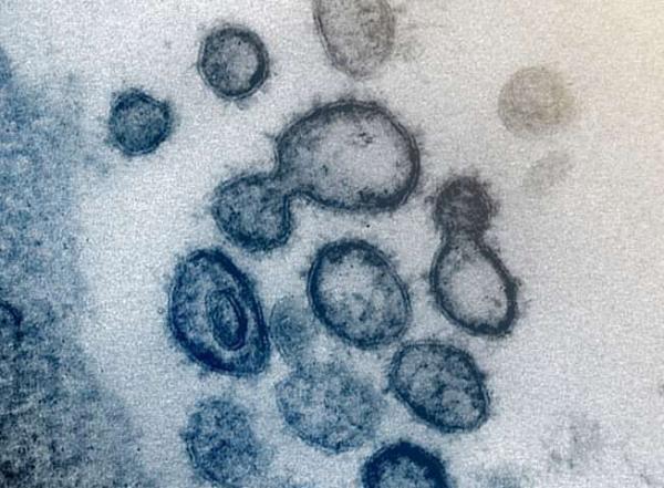 درمان ویروس کرونا با آنتی بادی تصویب شد