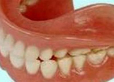 طرز مراقبت از دندان مصنوعی